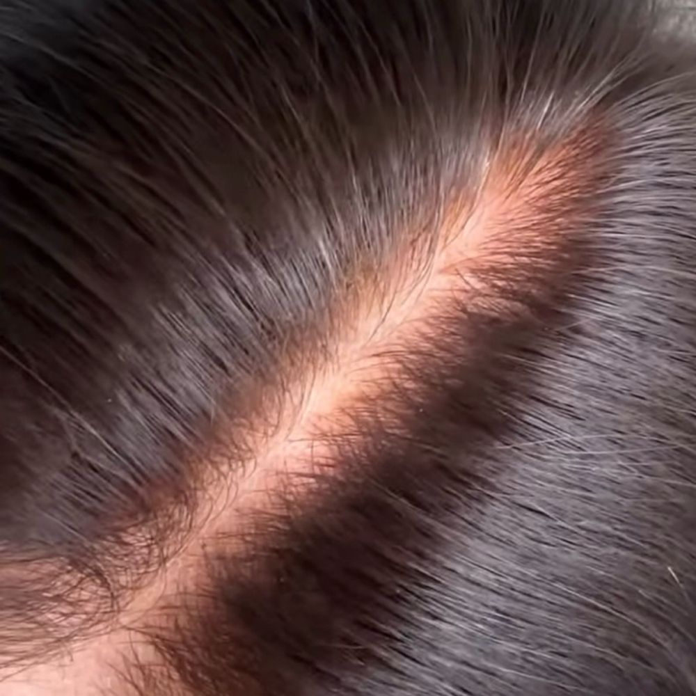 Scalp Exfoliation at Joan & Co in Mankato, MN