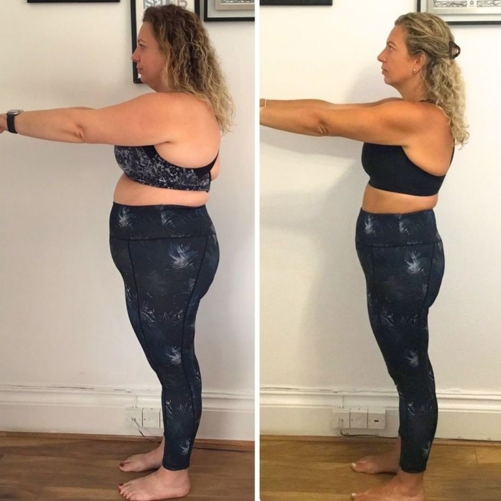 Weight Management- Monthly Treatmen at D'Yalorde Wellness & Aesthetics LLC in El Paso, TX