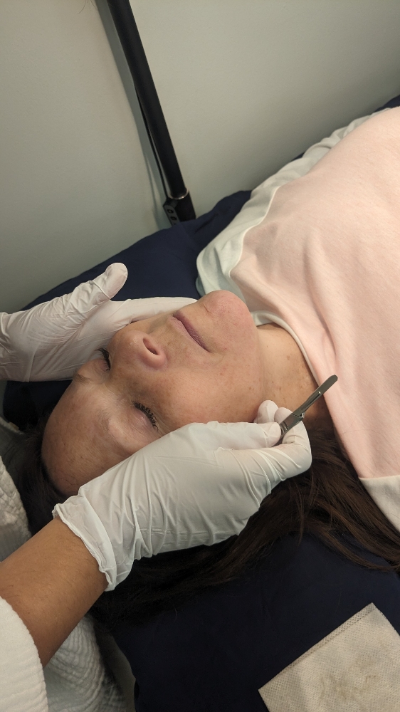 Dermaplaning+Mini Facial