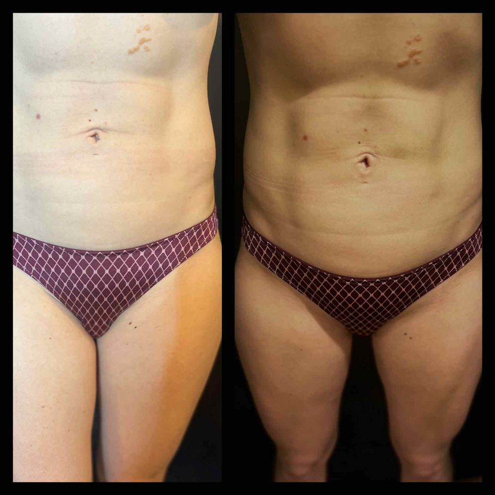 Contour Tan! ✨👙