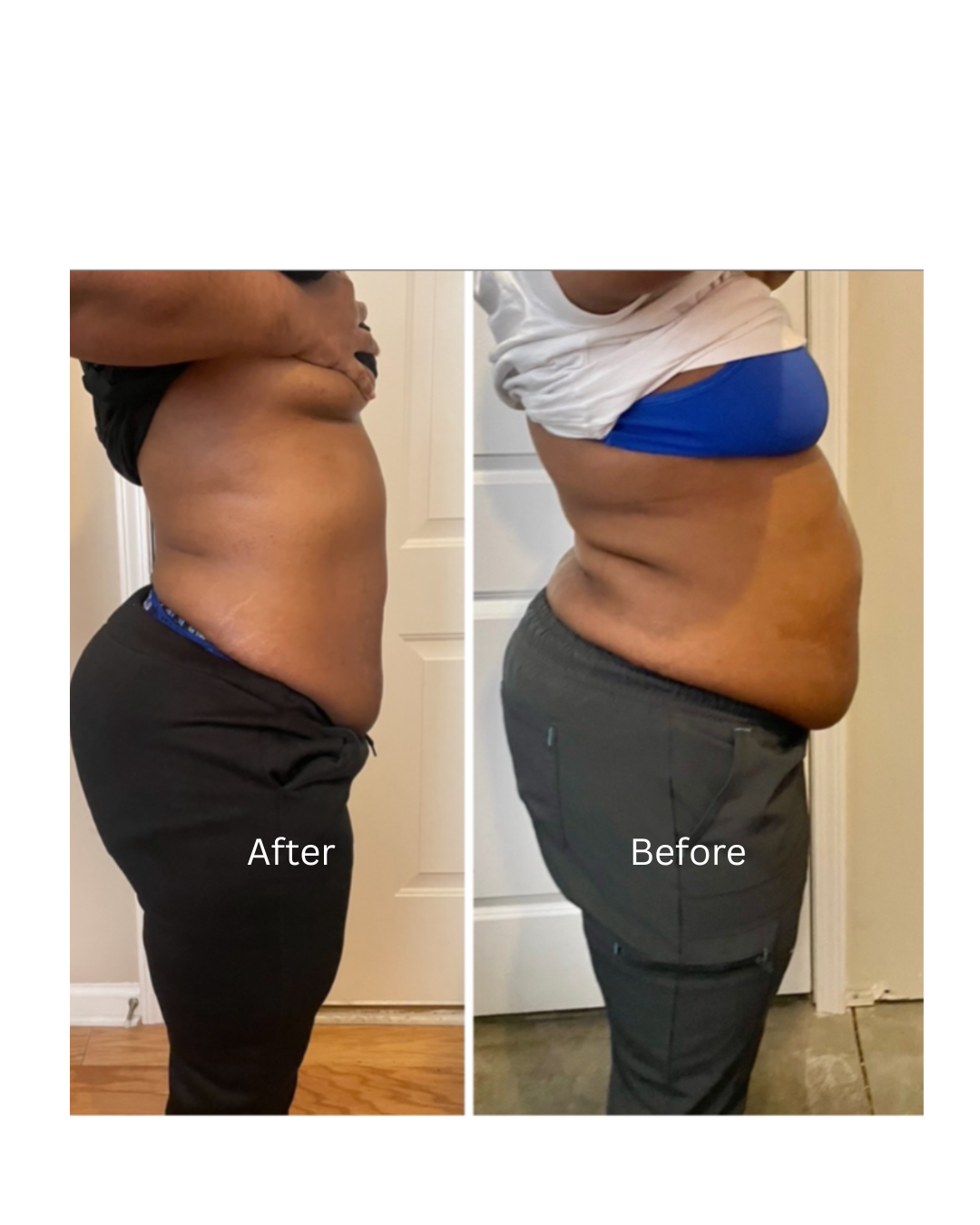 GLP-1 / Skin Tight (Series of 3)