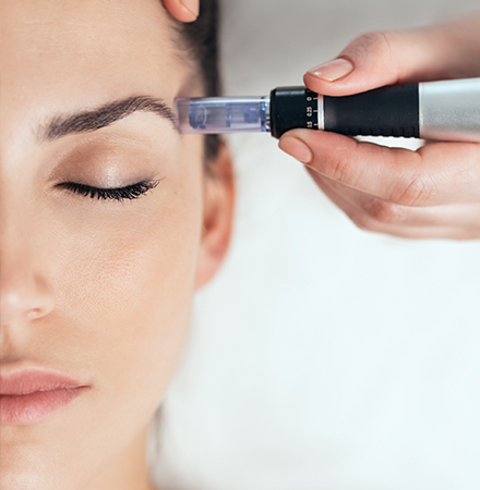 MICRONEEDLING / Ze-Tox No Toxin at Mily Gerig Skincare Glow LLC in Lincoln, RI