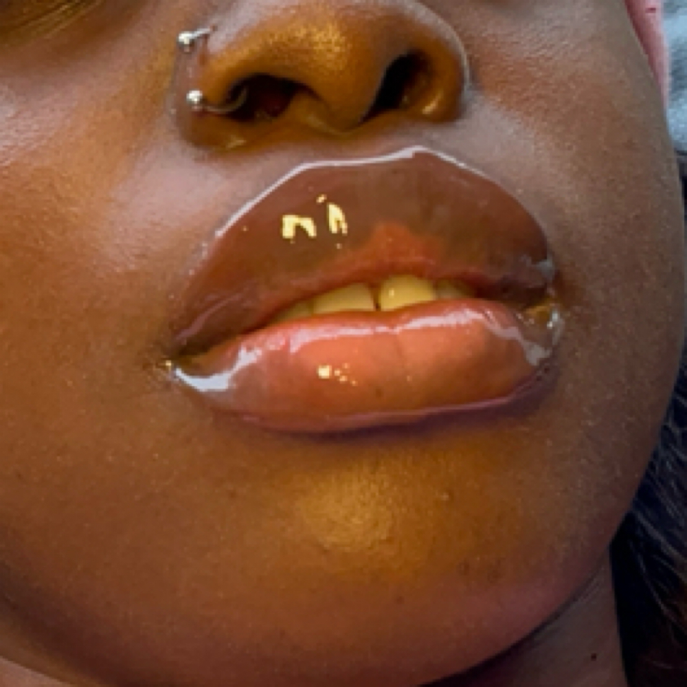 Micro Needle Lip Filler Special at Melo Tattz X Beauty in Houston, TX