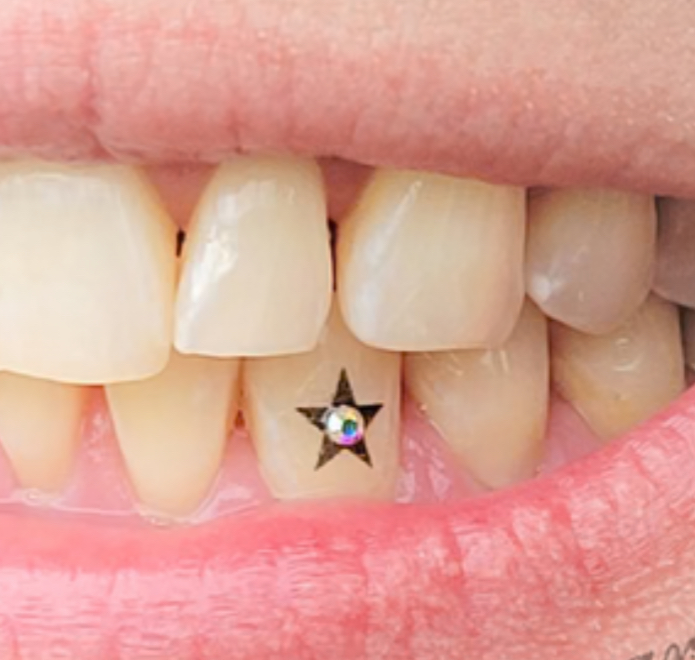 Tooth Gem, Temptatooth, or Combo
