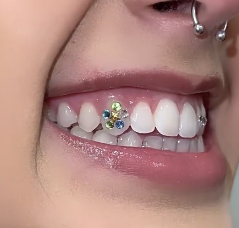 Flower Design Tooth Gems
