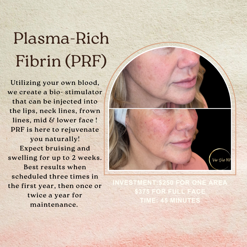 PRF Treatment