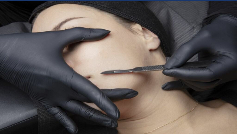 Dermaplaning