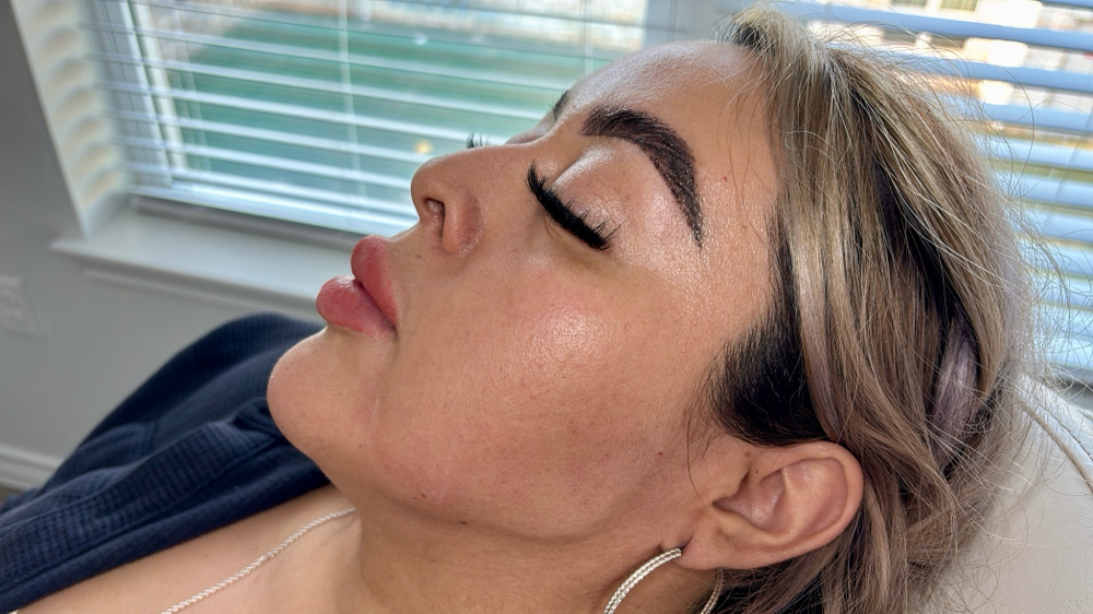 Jaw Contour  Filler
