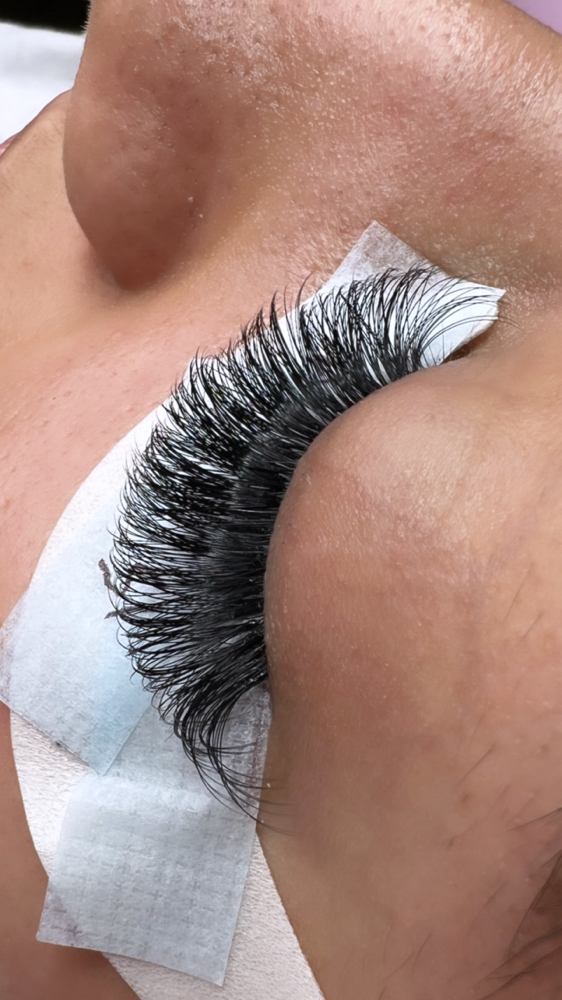 Mega Volume Fill