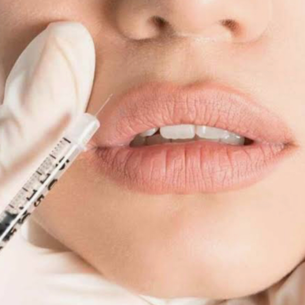 Botox Lip Flip at Belle Sculpted Aesthetics, LLc in Lake Jackson, TX