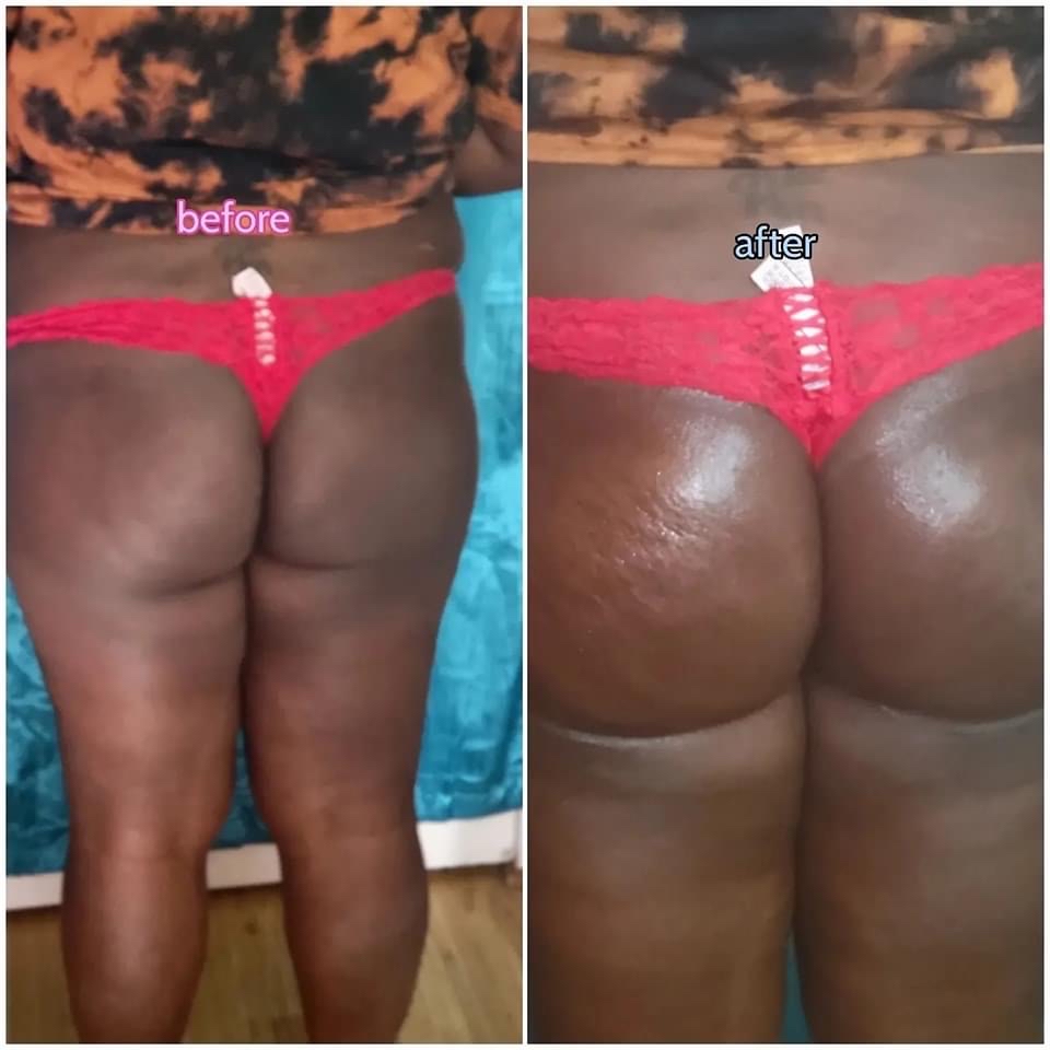 Ultimate Butt Lift