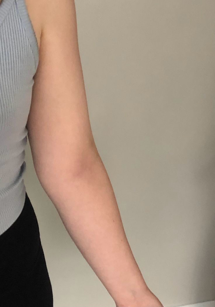 Arms (full)