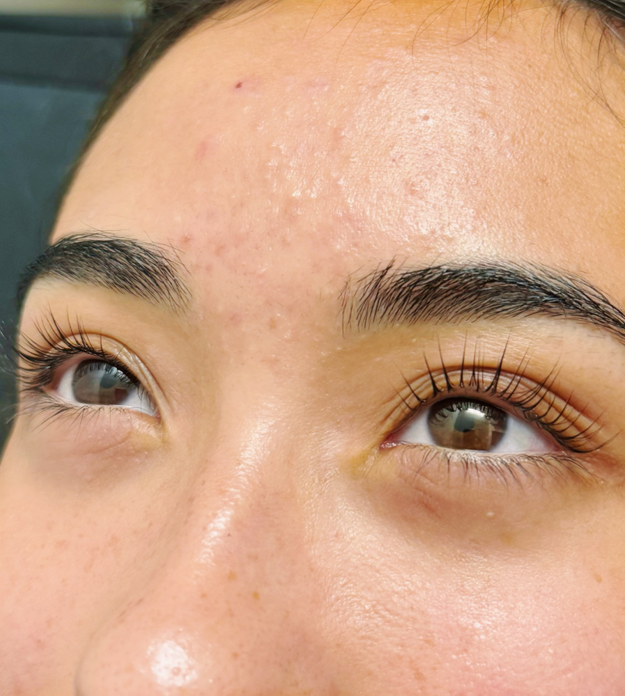 Lash Lift