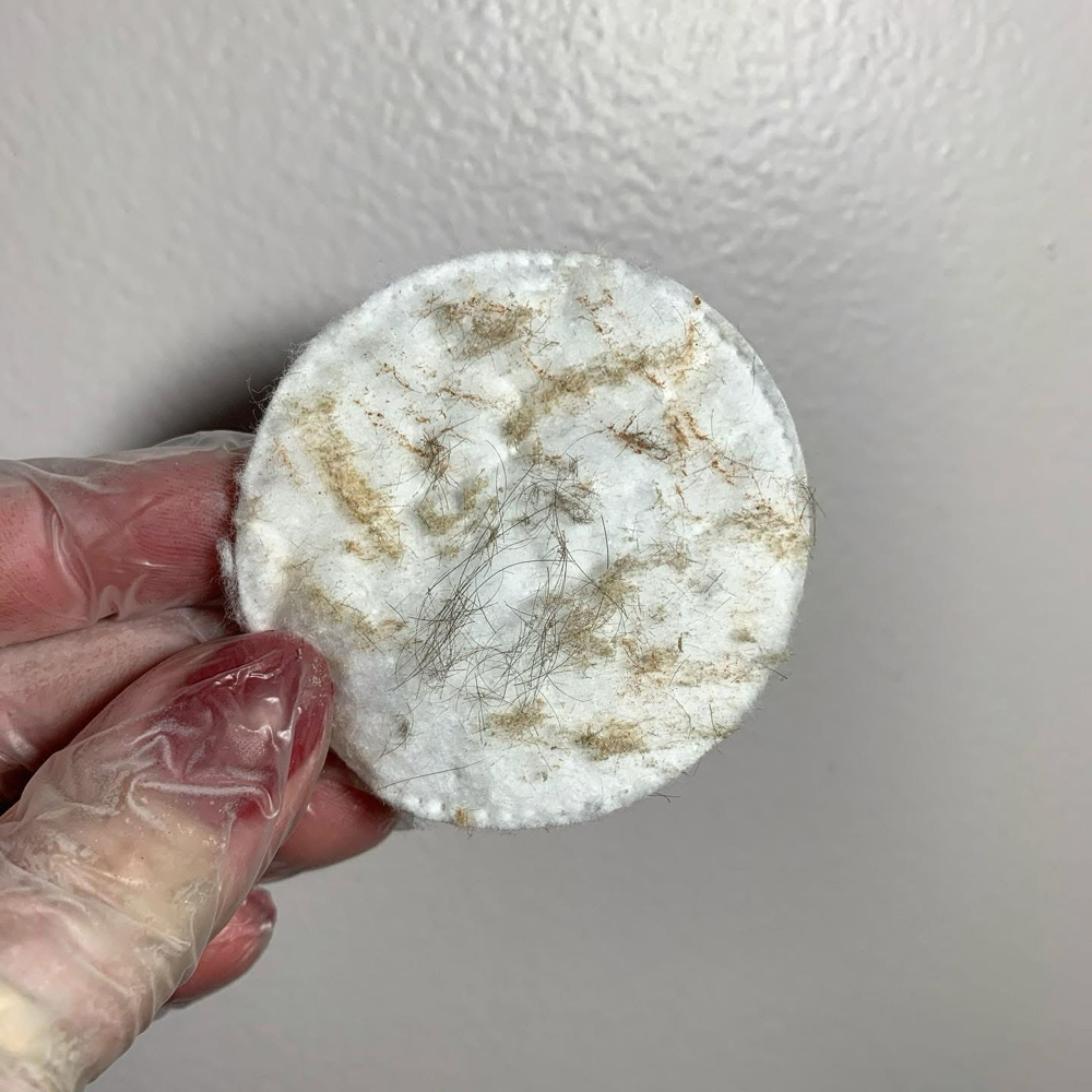 Dermaplanning + Mask at Your Esti Bestie Via in Overland Park, KS