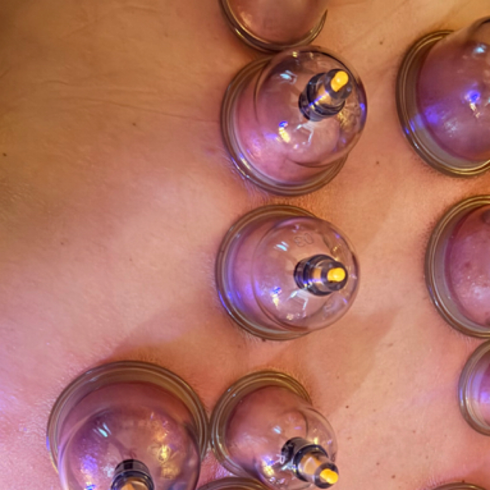 Target Cupping Therapy Session at Joni’s stretching massages in Sidney, OH
