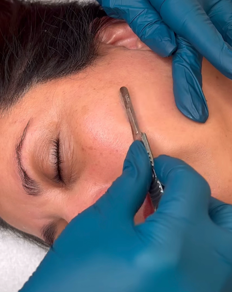 ReNew Dermaplaning Facial