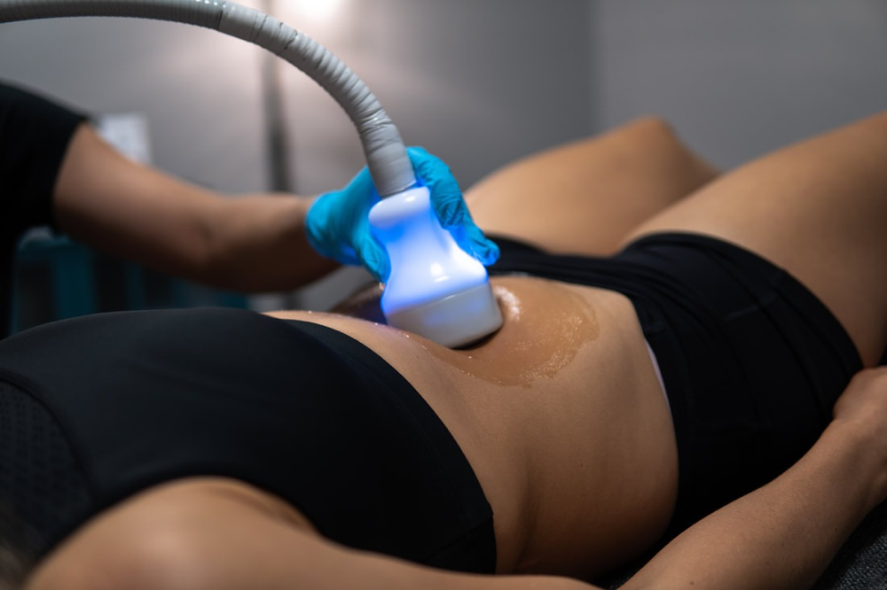 CRYO SLIMMING