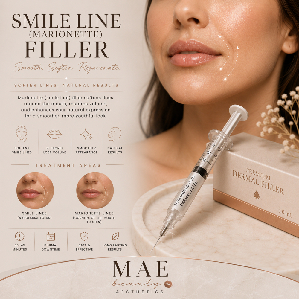 Smile Line Filler at MaeBeauty in Mesquite, TX