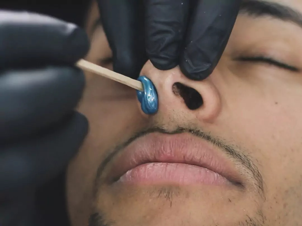 Wax: Nostrils