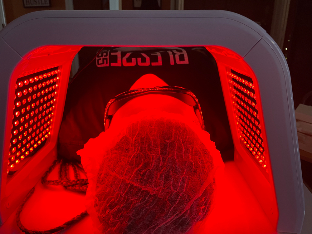 Microdermabrasion With Light