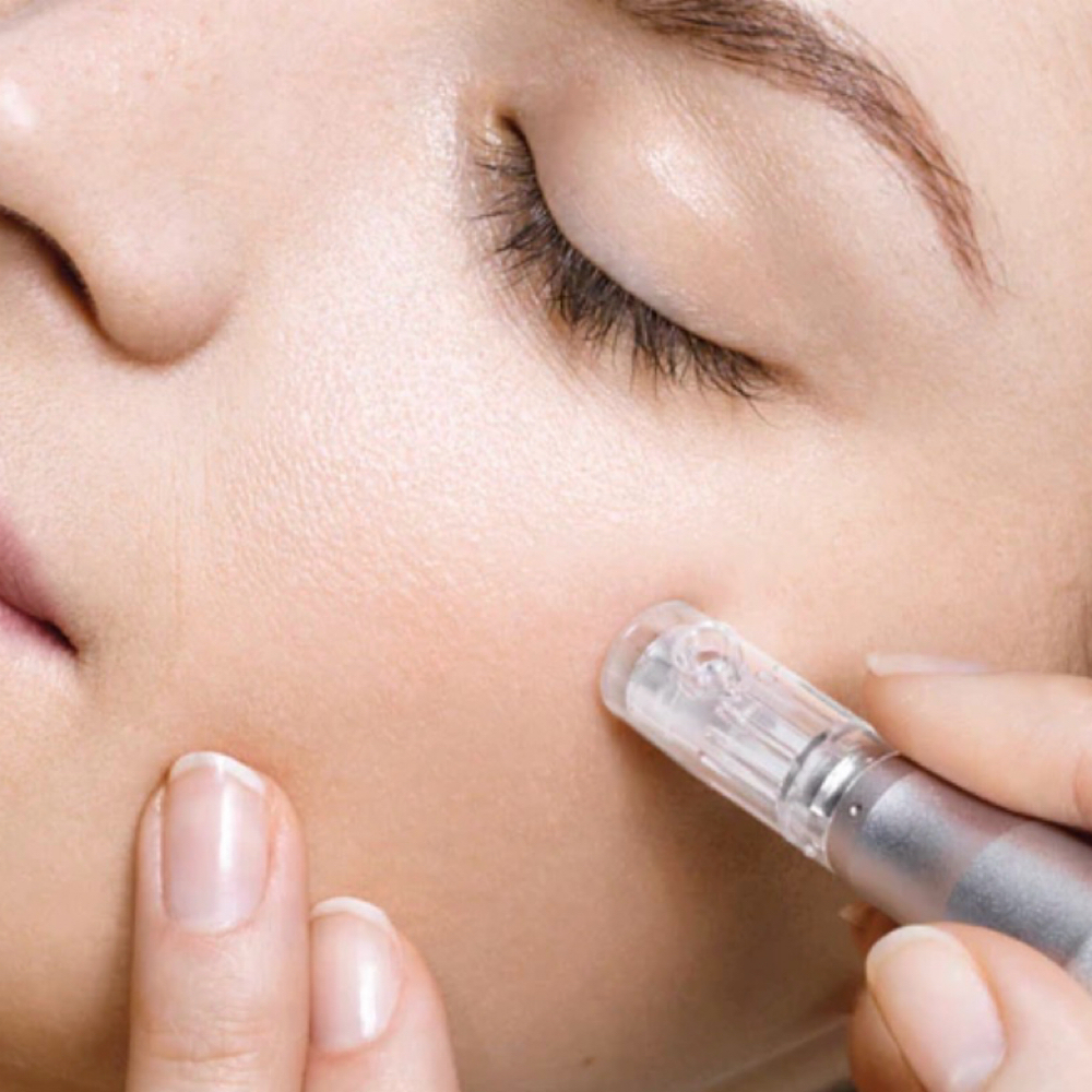 MICRONEEDLING at The Utah Spa and Wellness Center in Provo, UT