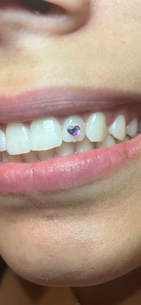 Heart Shaped Tooth Gem