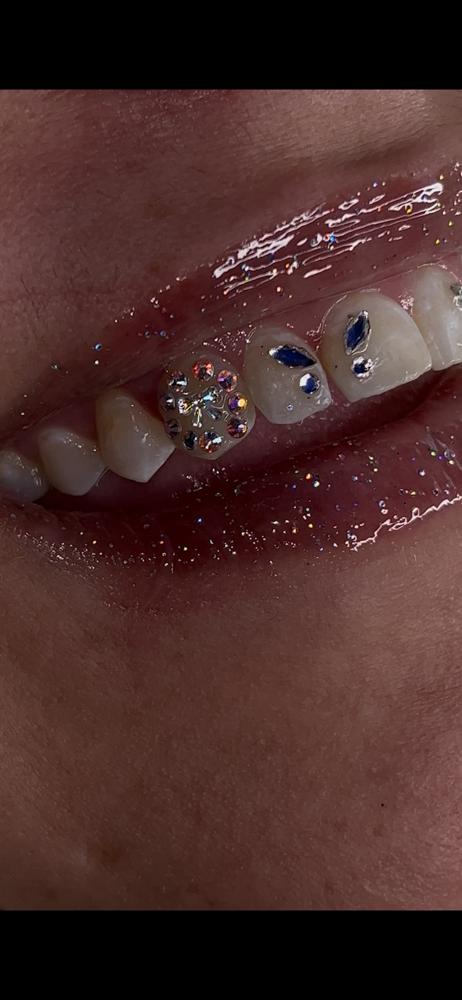 πππTooth Gem Freestyle Sets ππ