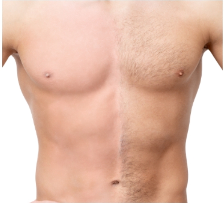 Chest Waxing