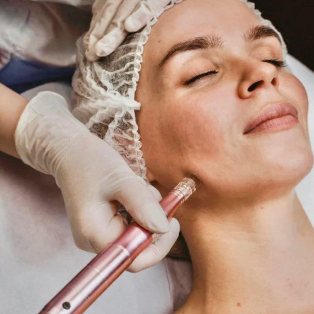 Neocollagenisis Infusion at River & Clay Esthetics in Agawam, MA