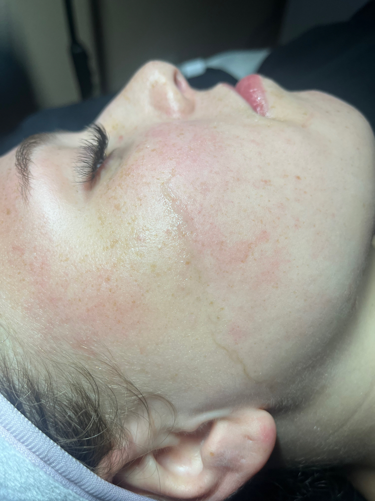 Dermaplane Facial at Holistic Skin Haven in Van Buren, AR