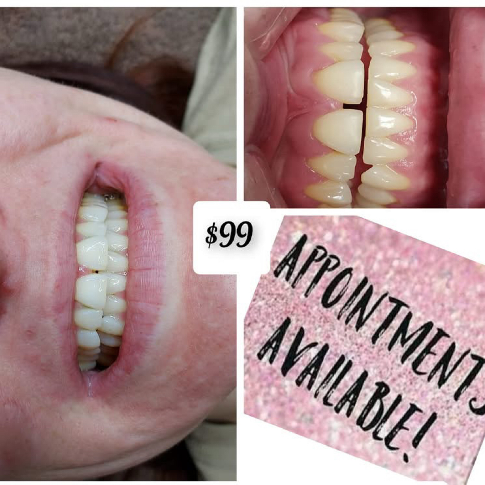 Teeth Whitening at Amanda Smith Inside Bellissimo Salon in Lacrosse, WI