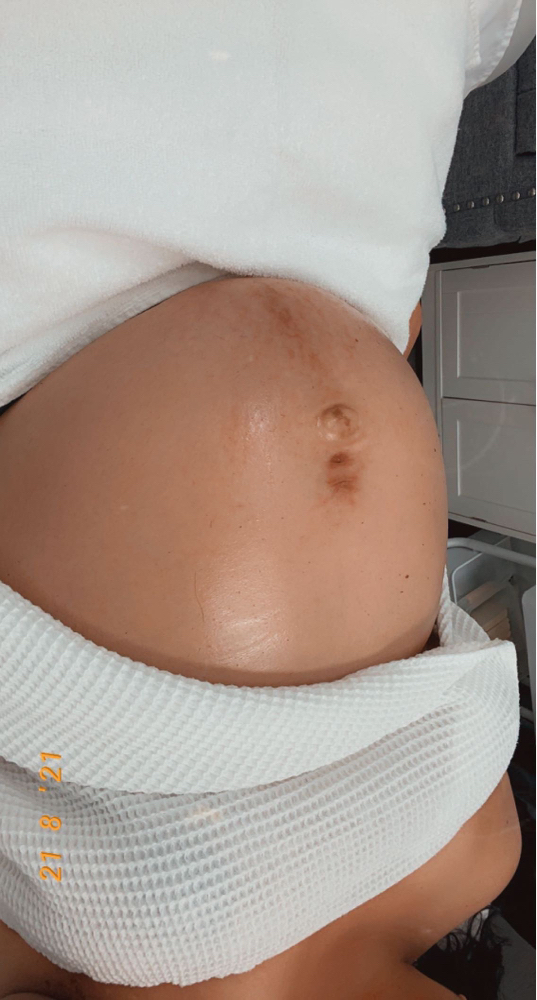 Pregnacy Belly Glow