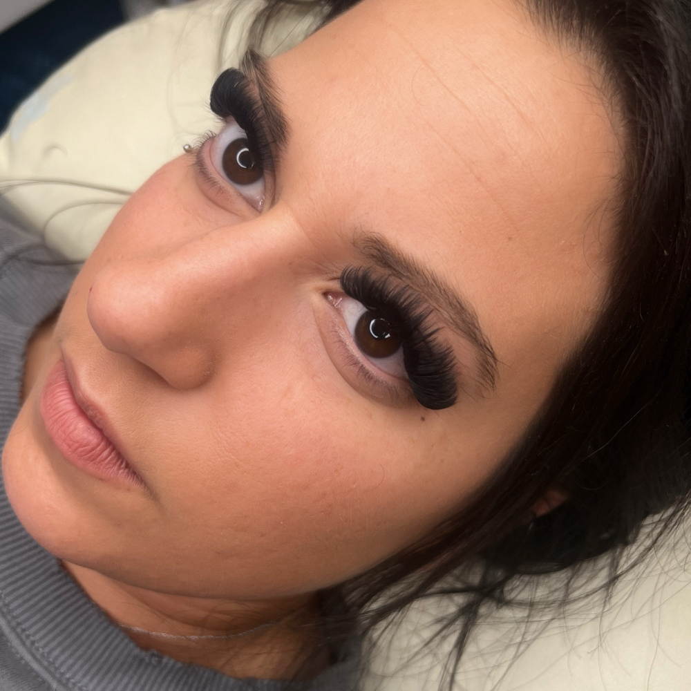 Volume ( MEGA ) at BeautyclinicLLC in Fairfield, CT