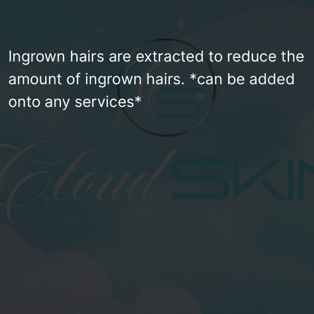Extractions at Cloud Skin Esthetics LLC. in Redford, MI