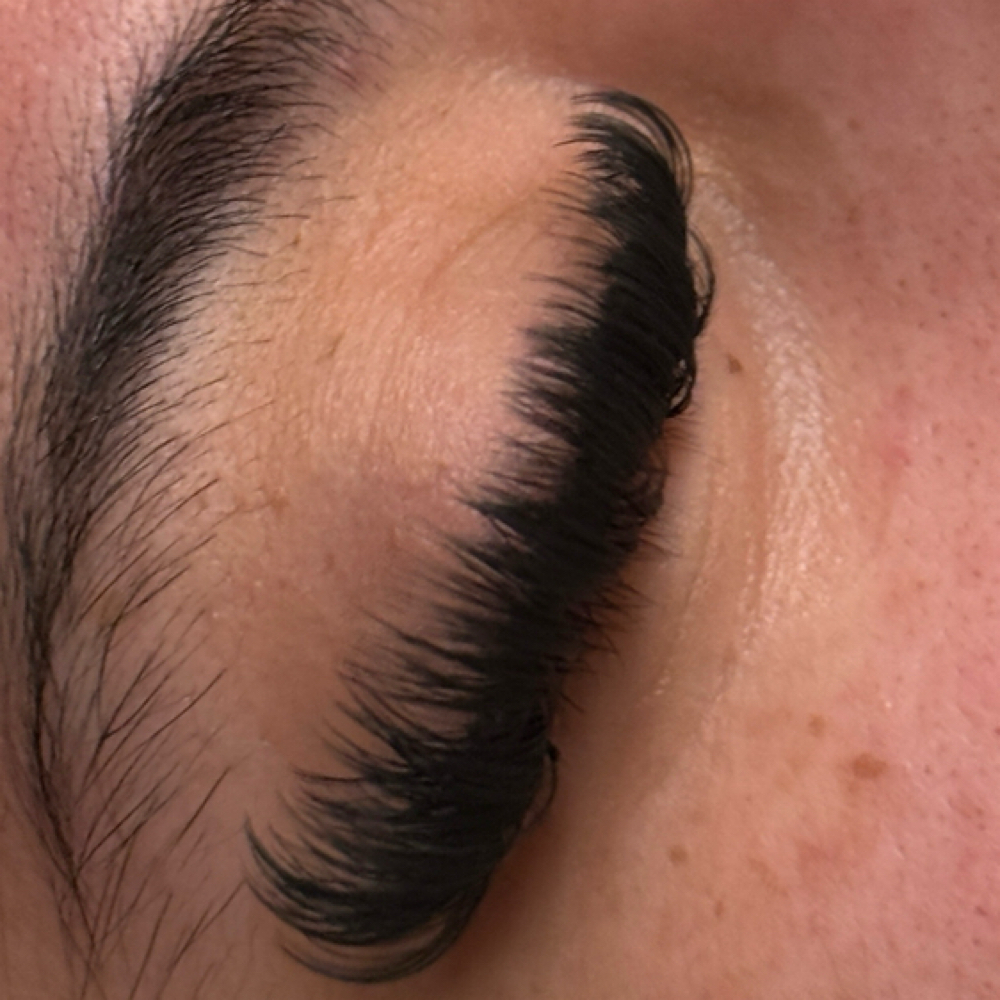 3 week fill at Raesthetics LLC in Fort Morgan, CO