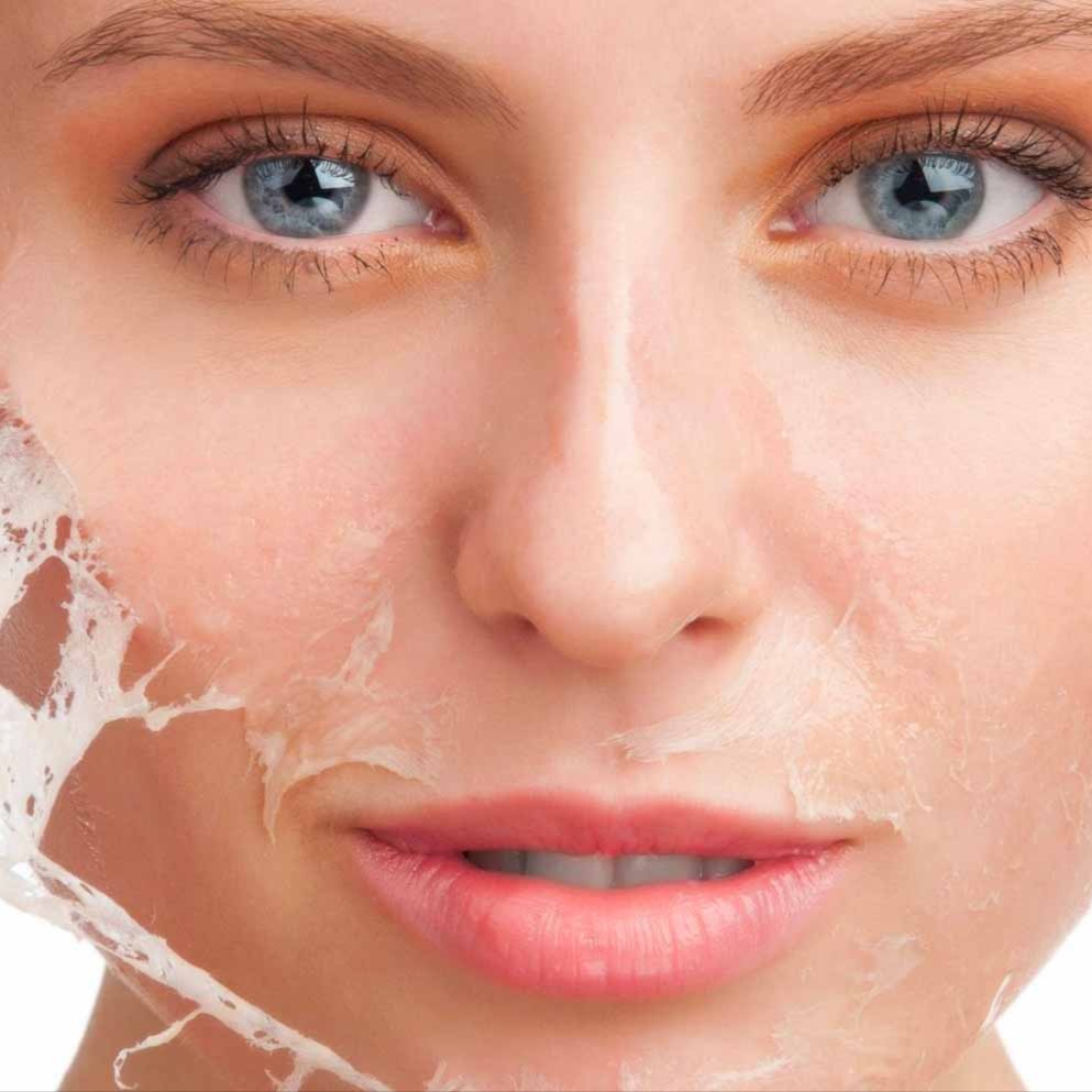 Facial para Piel Acneica at Irines Spa in Roanoke, VA