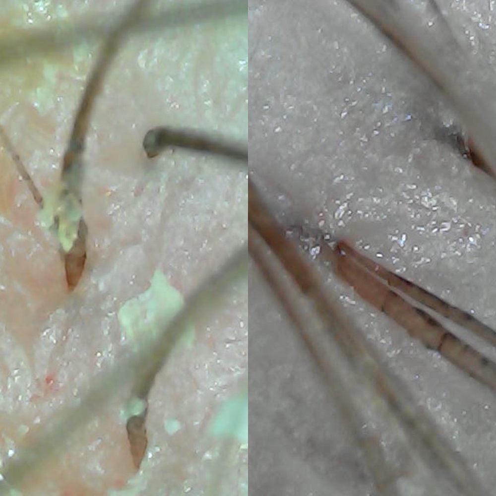 Headlab Scalp Exam And Treatment