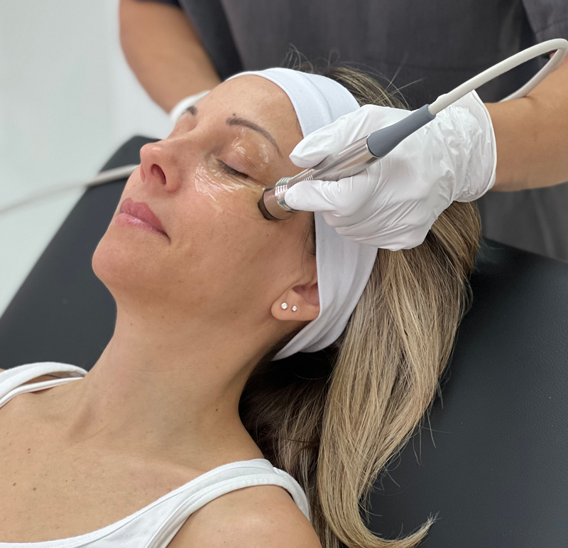 RF Dry Eye Therapy