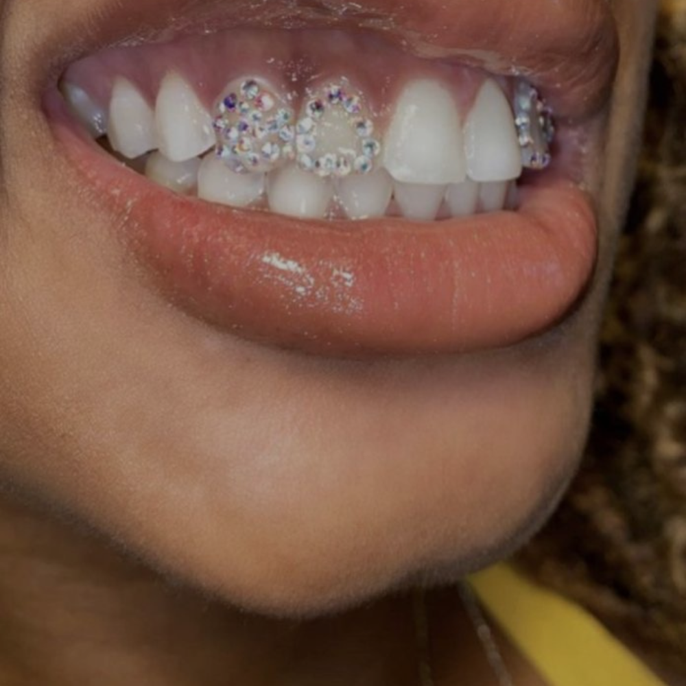 Entire Tooth