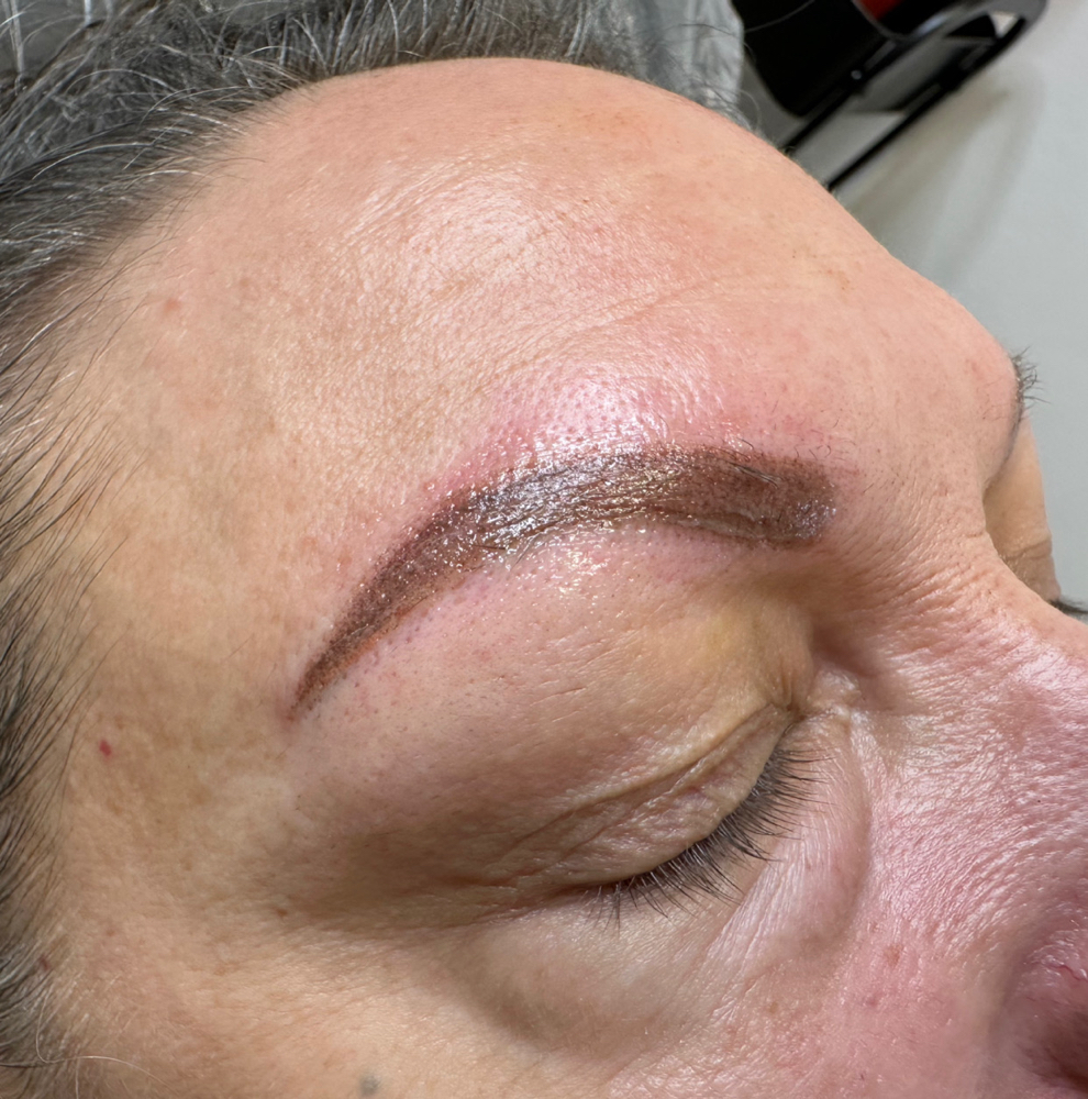 Coverup/Color Correction