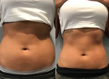 Belly Balanced Contour