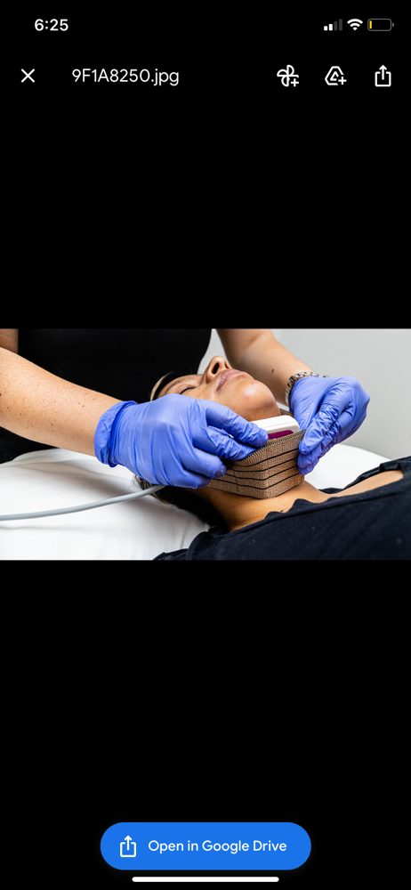Lipo Papada/Chin Lipo