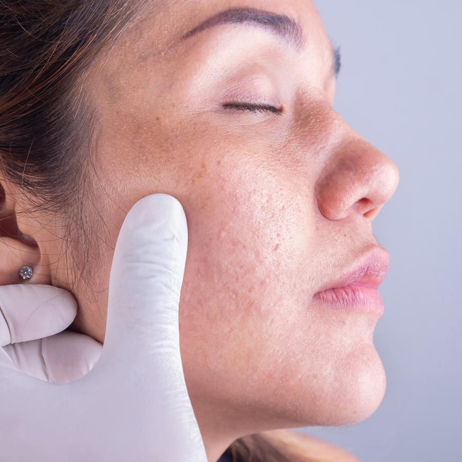 CONSULTA DERMA GENERAL at Natural Glow in Grand Praire, TX