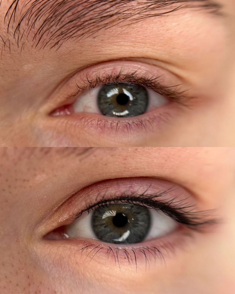Lash Enhancement