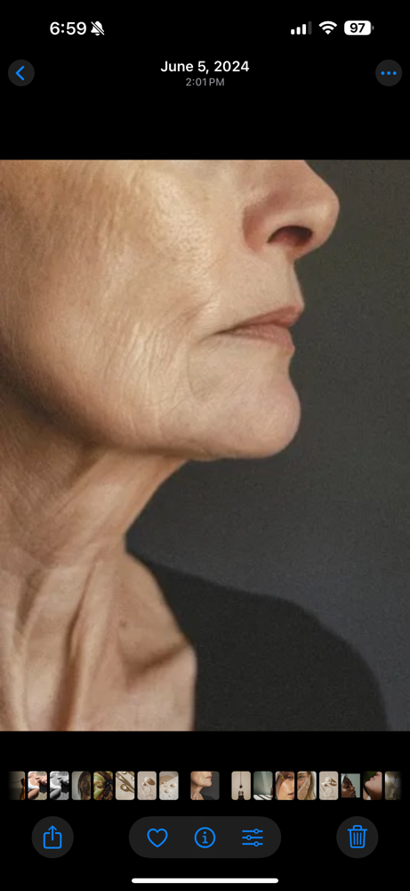 PCA Ultra Peel