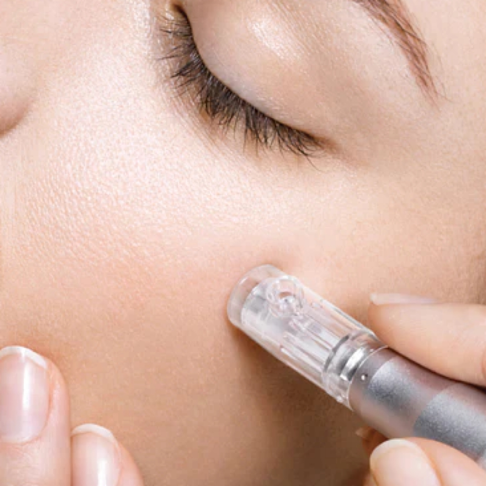 Mircro Needling at Volume Beauty Lounge in Augusta, GA