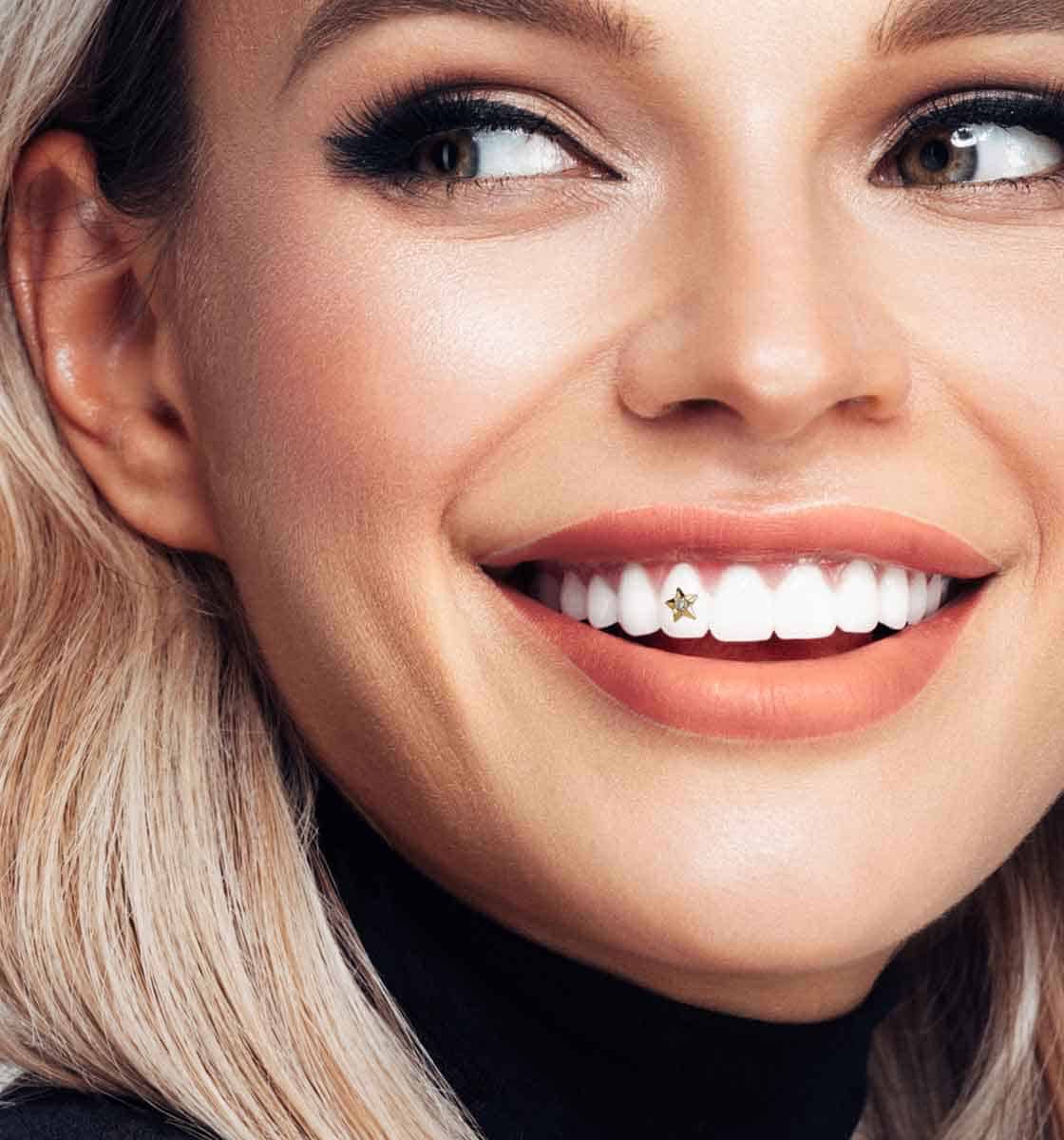 Tooth Gems