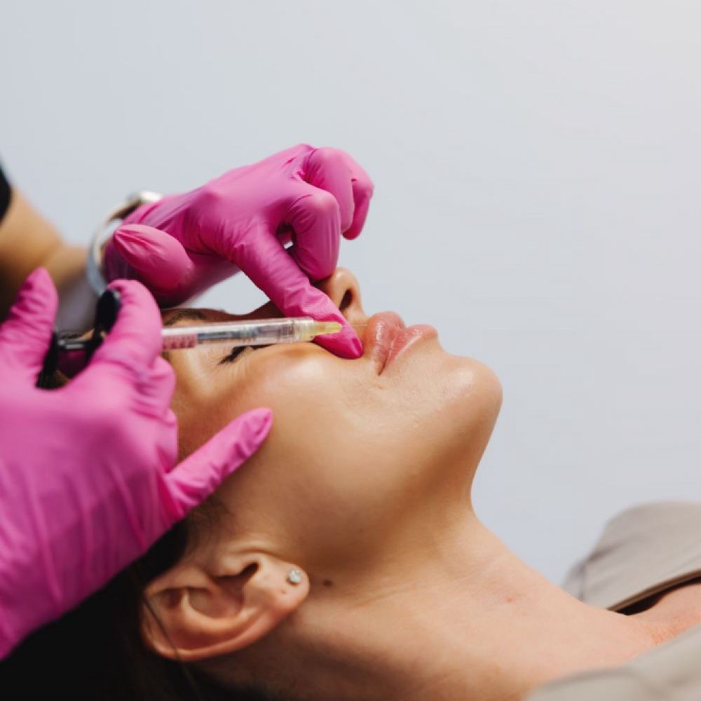 Lip Filler at Sharon Nicole Aesthetics in Patchogue, NY