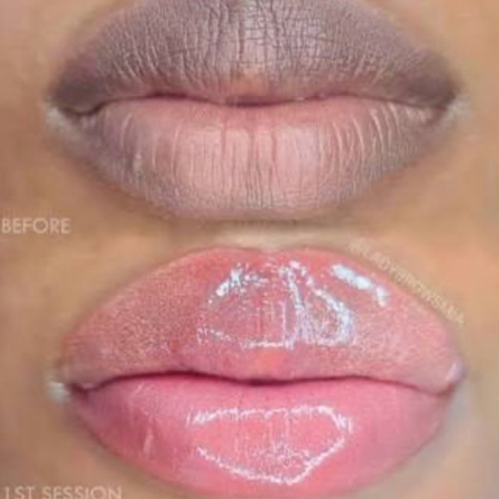 Lip Neutralization (Second Session) at NAIL CARE OF PLAINFIELD in Plainfield, IL