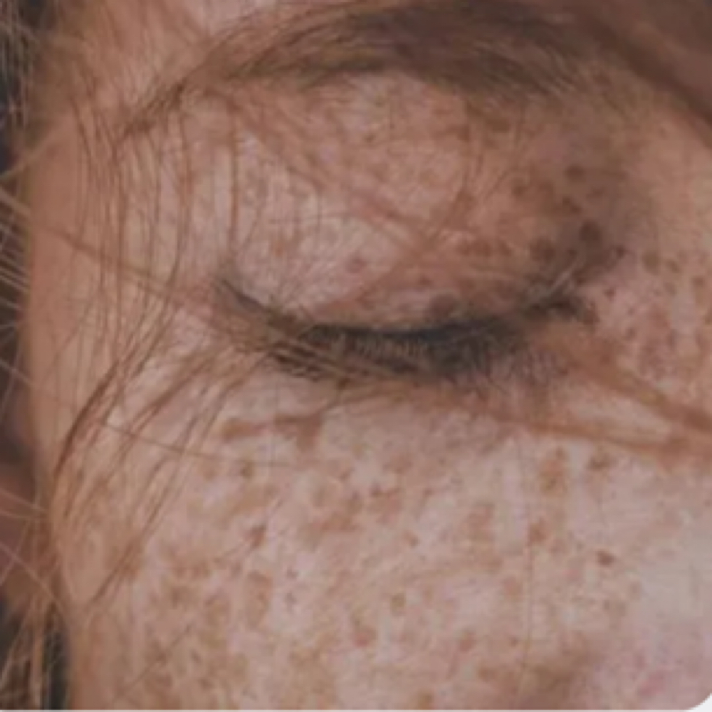 Freckles at Studio M Beauty Co. in Salem, OR